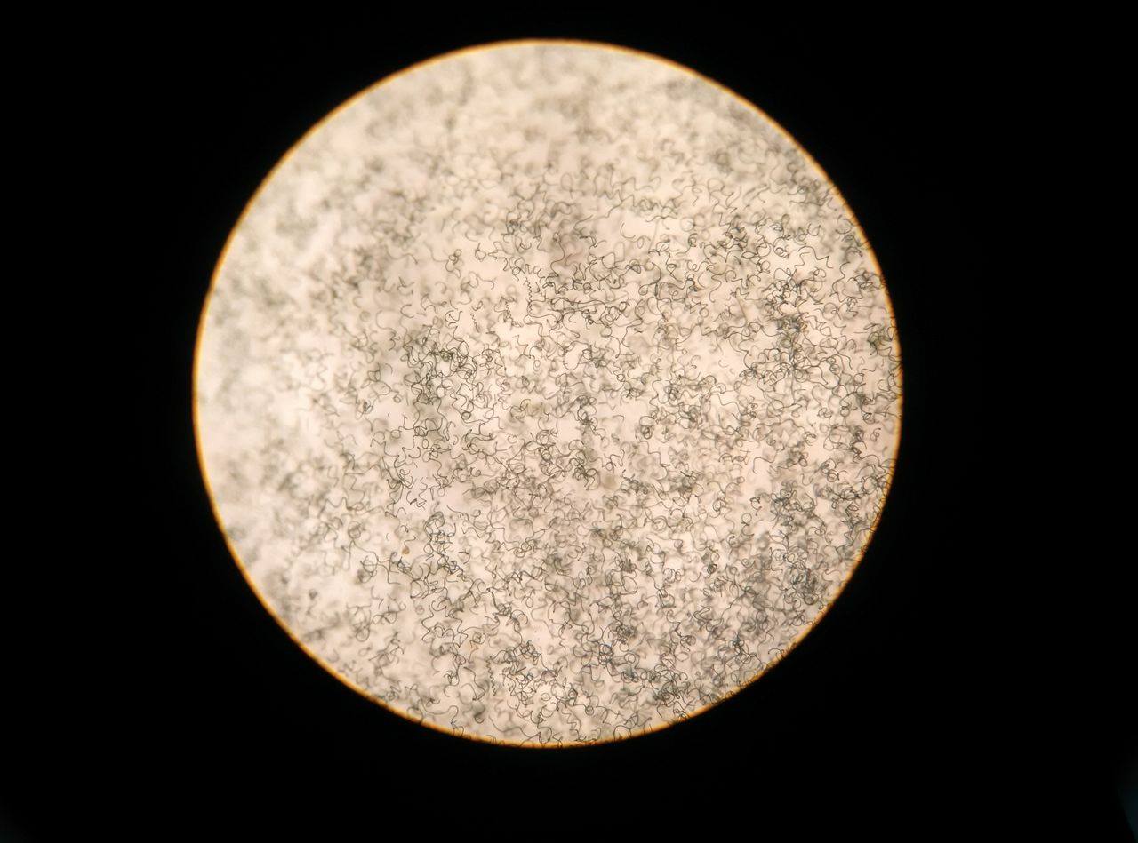 顯微鏡下顯示純正螺旋藻，不含其他雜質。